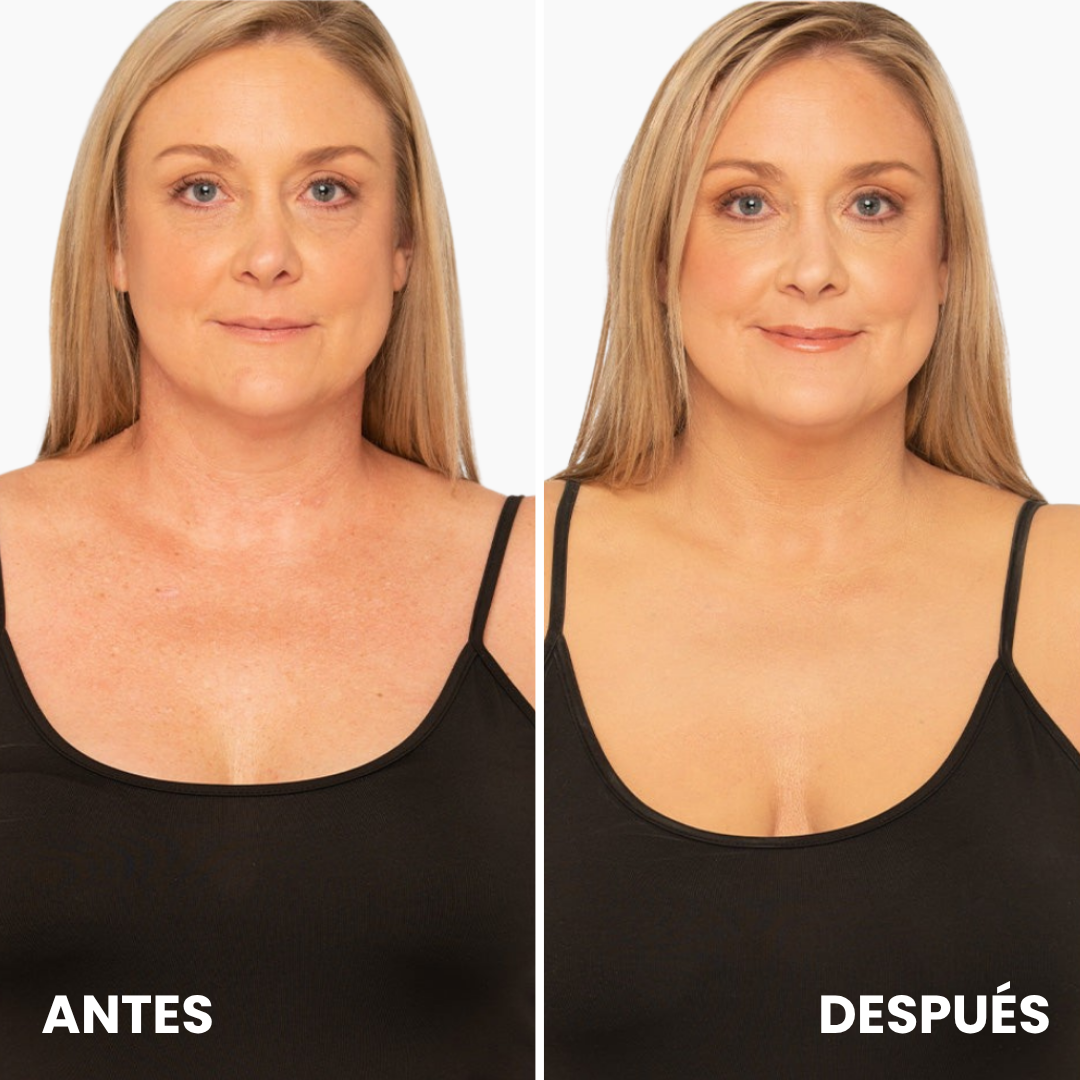 Corrector Corporal