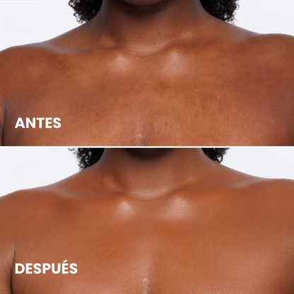 Corrector Corporal