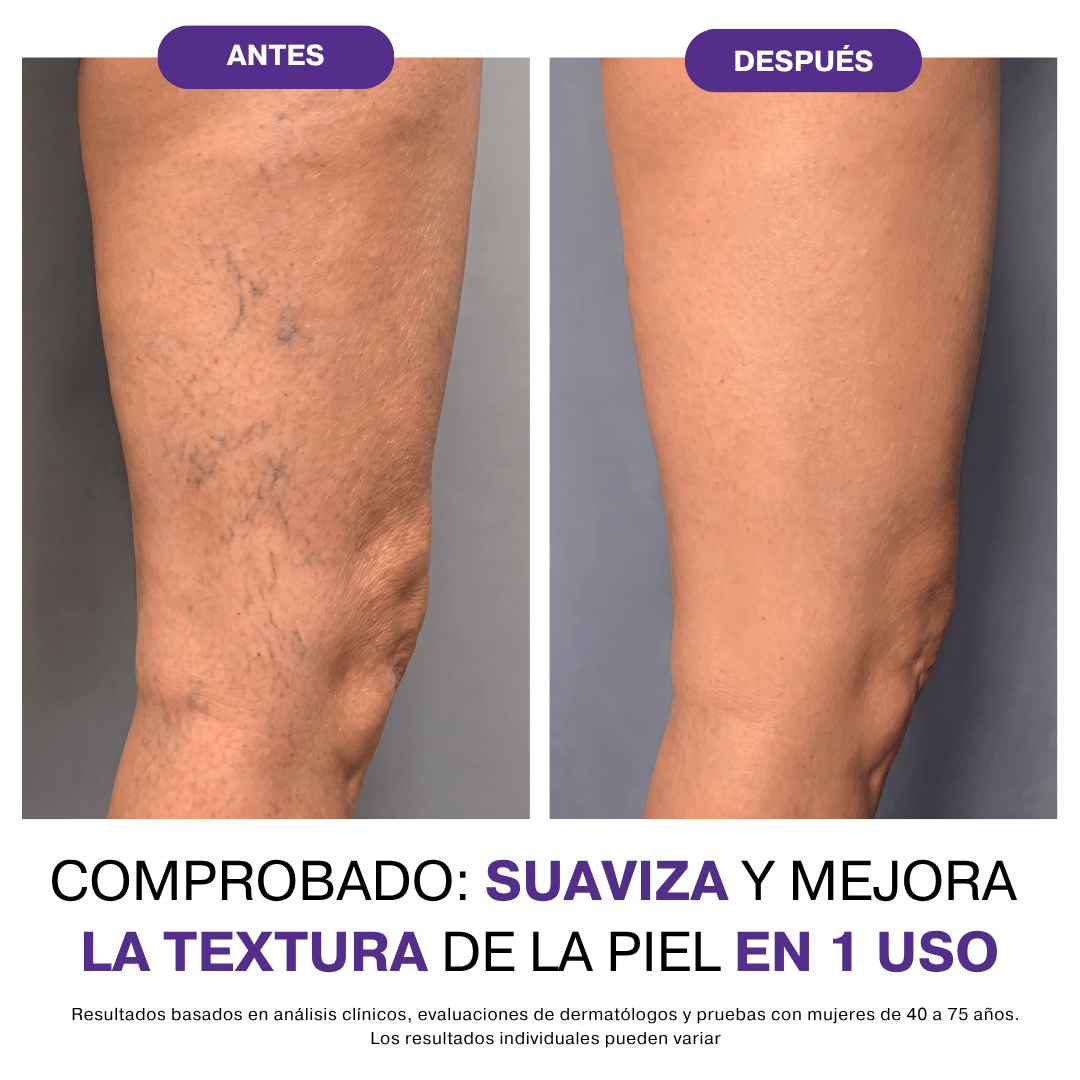 Grove® Corrector Corporal