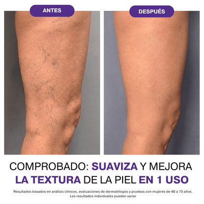 Grove® Corrector Corporal